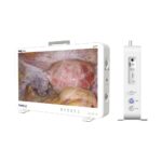 CF927 27inch portable endoscope camera - Image 3