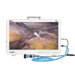 CK932 32 Inch 4K UHD All-in-One Portable Endoscope Camera