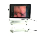 Flexible Disposable Ureteroscope