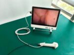 Flexible Disposable Ureteroscope - Image 3