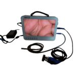 CF916 15.6 inch portable endoscope camera - Image 2