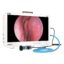 Camjoy CF916 Portable 15.6 FHD Endoscopic Camera System All-in-One ENT Unit FHD 01