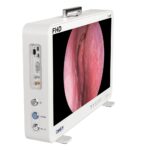 Camjoy CF916 Portable 15.6 FHD Endoscopic Camera System All-in-One ENT UnitFHD 03