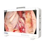 Camjoy CF927 27 Large Screen FHD Endoscope Camera System Surgical Visualization FHD 02