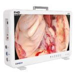 Camjoy CF927 27 Large Screen FHD Endoscope Camera System Surgical Visualization FHD 03