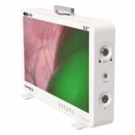 Camjoy CG932 32inch 4K-ICG FPGA Endoscope Camera System 02