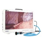 Camjoy CP927 27 4K-FPGA Endoscopic Camera System Wide Color Gamut 01