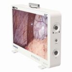 Camjoy CP932 32 Flagship 4K-FPGA Camera System Ultimate Surgical Visualization 02