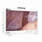 Camjoy CP932 32 Flagship 4K-FPGA Camera System Ultimate Surgical Visualization 03