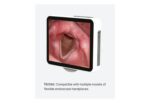 Camjoy CY035 Dedicated Medical Display detail image 1