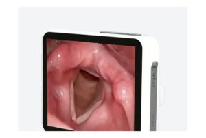Camjoy CY035 Dedicated Medical Display Display and control detail
