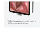 Camjoy CY035 Dedicated Medical Display detail image 3