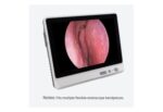 Camjoy CY121 Universal Medical Display detail image 1