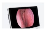 Camjoy CY121 Universal Medical Display detail image 2