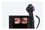 Camjoy CY121T Series All-in-One Endoscope Processor detail image 2