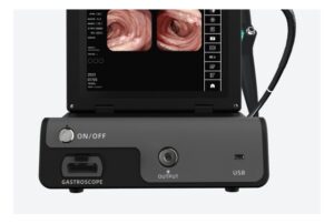 Camjoy CY121T Series All-in-One Endoscope Processor Connection and accessory detail