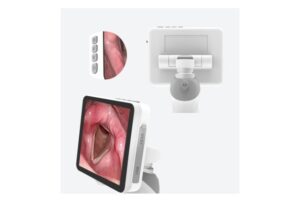 Camjoy LD101 Disposable-Blade Video Laryngoscope Handle and control detail