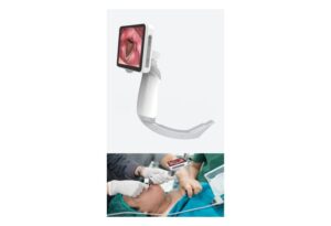 Camjoy LR101 Reusable-Blade Video Laryngoscope Full product view
