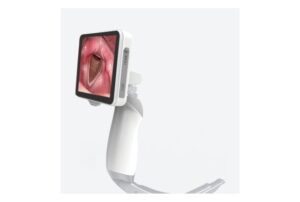 Camjoy LR101 Reusable-Blade Video Laryngoscope Handle and control detail