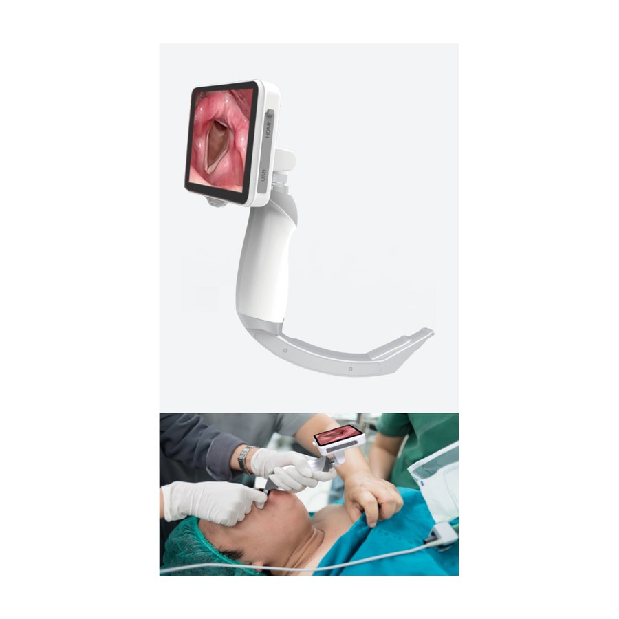 Camjoy LR101 Reusable-Blade Video Laryngoscope main product image Camjoy LR101 Reusable-Blade Video Laryngoscope main product image