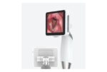 Camjoy LR102 Reusable Rigid Video Laryngoscope detail image 2