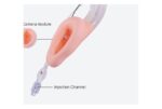 Camjoy VM101 Video Laryngeal Mask detail image 3
