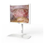 Camjoy CF0 19-inch white FHD surgical monitor perspective view