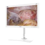 Camjoy CF0 27-inch white FHD surgical monitor front view