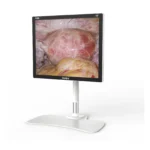 Camjoy CF1 19-inch black FHD surgical monitor perspective view