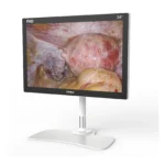 Camjoy CF1 24-inch black FHD surgical monitor perspective view