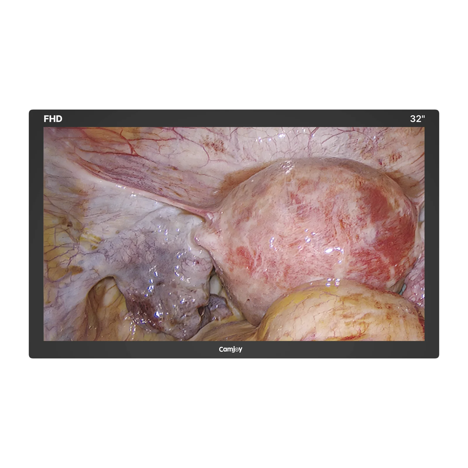 Camjoy CF1 32" - Vue de face