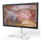 Camjoy CF1 32-inch black FHD surgical monitor perspective view