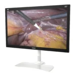 Camjoy CK1 32-inch black 4K surgical monitor perspective view